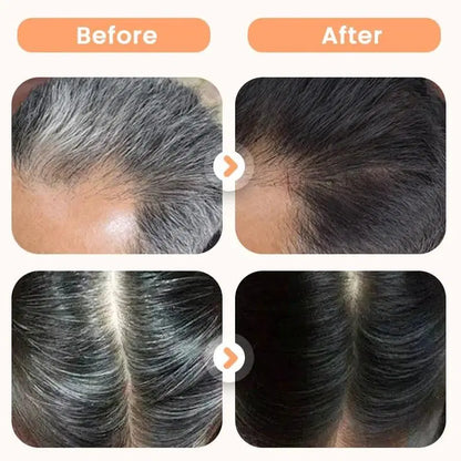 Plant Extract Hair Dye for Gray Hair 200 ml (Pack of 1)